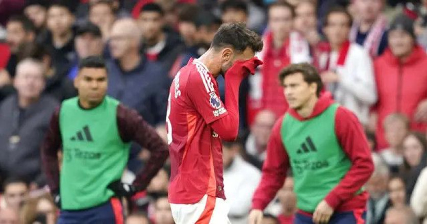 Manchester United Perlu Jual Pemain Usai Penampilan Buruk Lawan Burnley